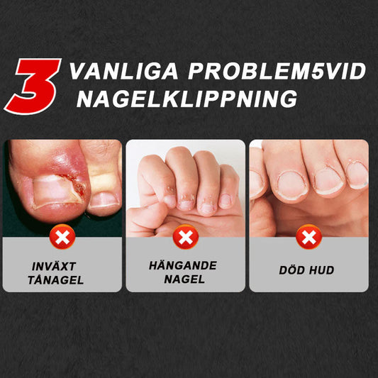 🔥Populär produkt från 2026🔥 Stänkskyddad nagelklippare med 25° vinklat blad, 3-delat set